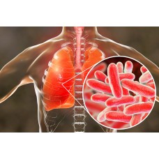 Vorbeugung von Legionellen im Haushalt